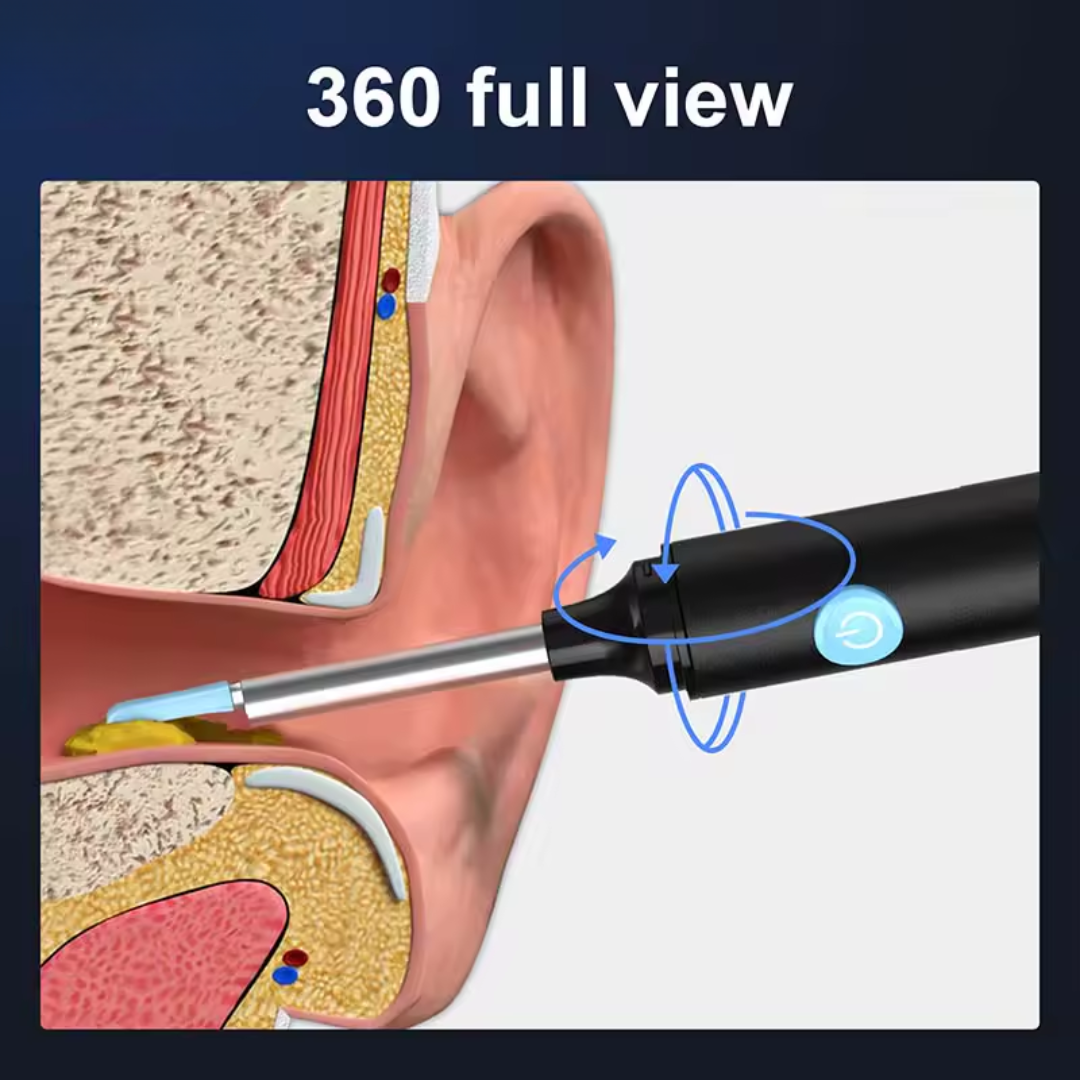 Ear Wax Removal Tool with Camera – HD Ear Cleaner with 6 LED Lights – Black