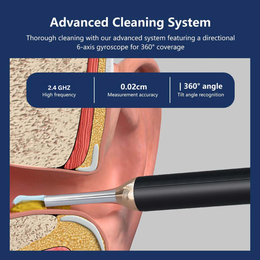 Ear Wax Removal Tool with Camera – HD Ear Cleaner with 6 LED Lights – Black